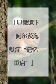 显微镜下：阿尔茨海默症“记忆重启”